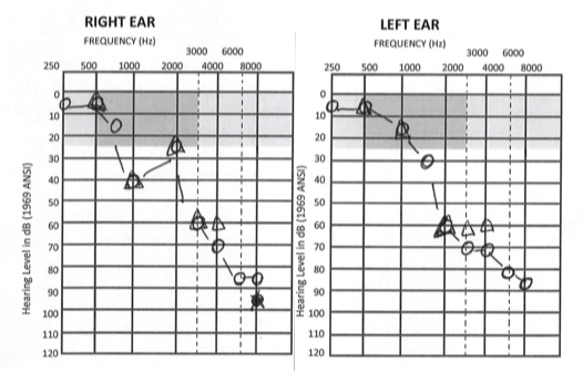 hearing test results